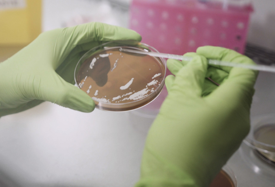 Aseptic sampling of yeast from an agar plate