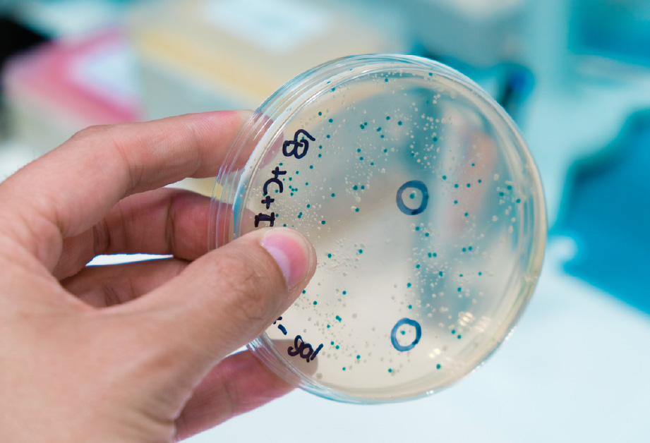 Isolated bacterial colonies on an agar plate